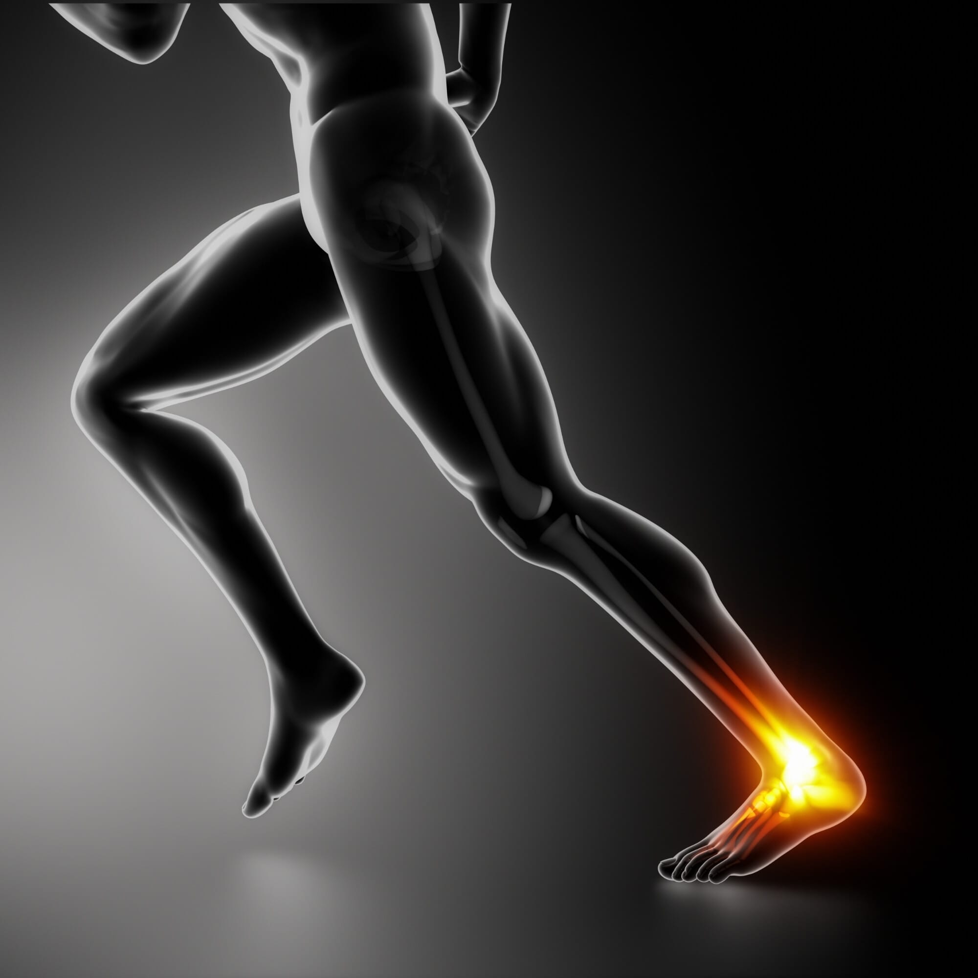 Aşil Yaralanması Gösterimi