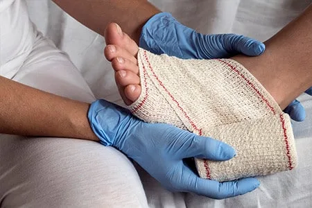 ayak bileği burkulması yaşamış ve sargıya alınmış bir ayak