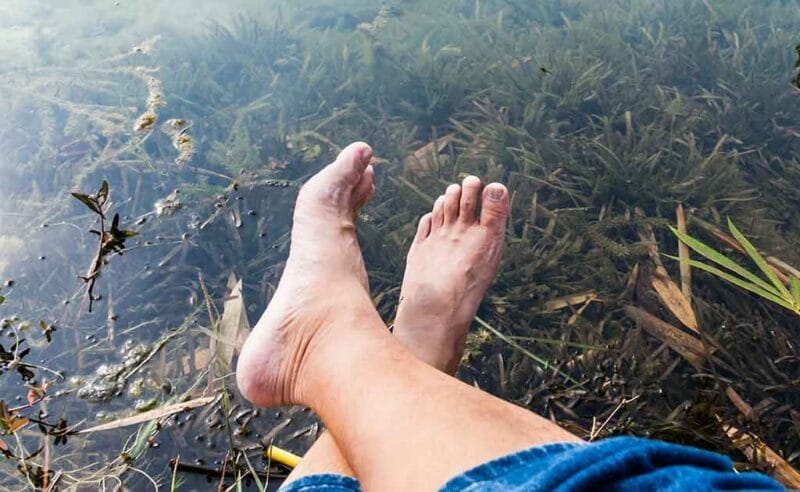 Eritrazma ve Diyabet Bağı