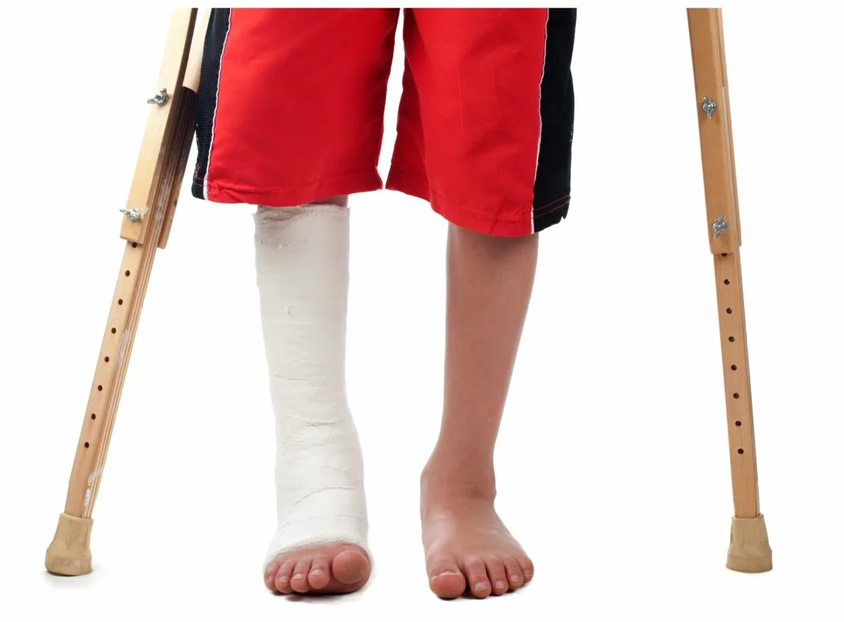 Naviküler Kırık Nedir? 1 naviküler kırık nedir?