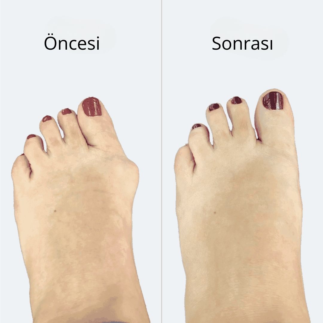 Selimmugrabi OnceSonra 1