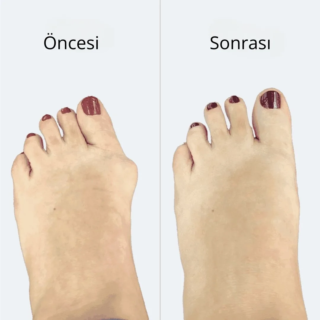 Selimmugrabi OnceSonra 1