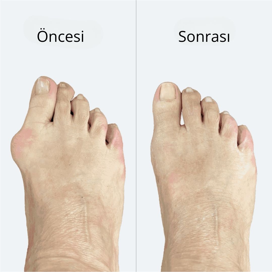 Selimmugrabi OnceSonra 2