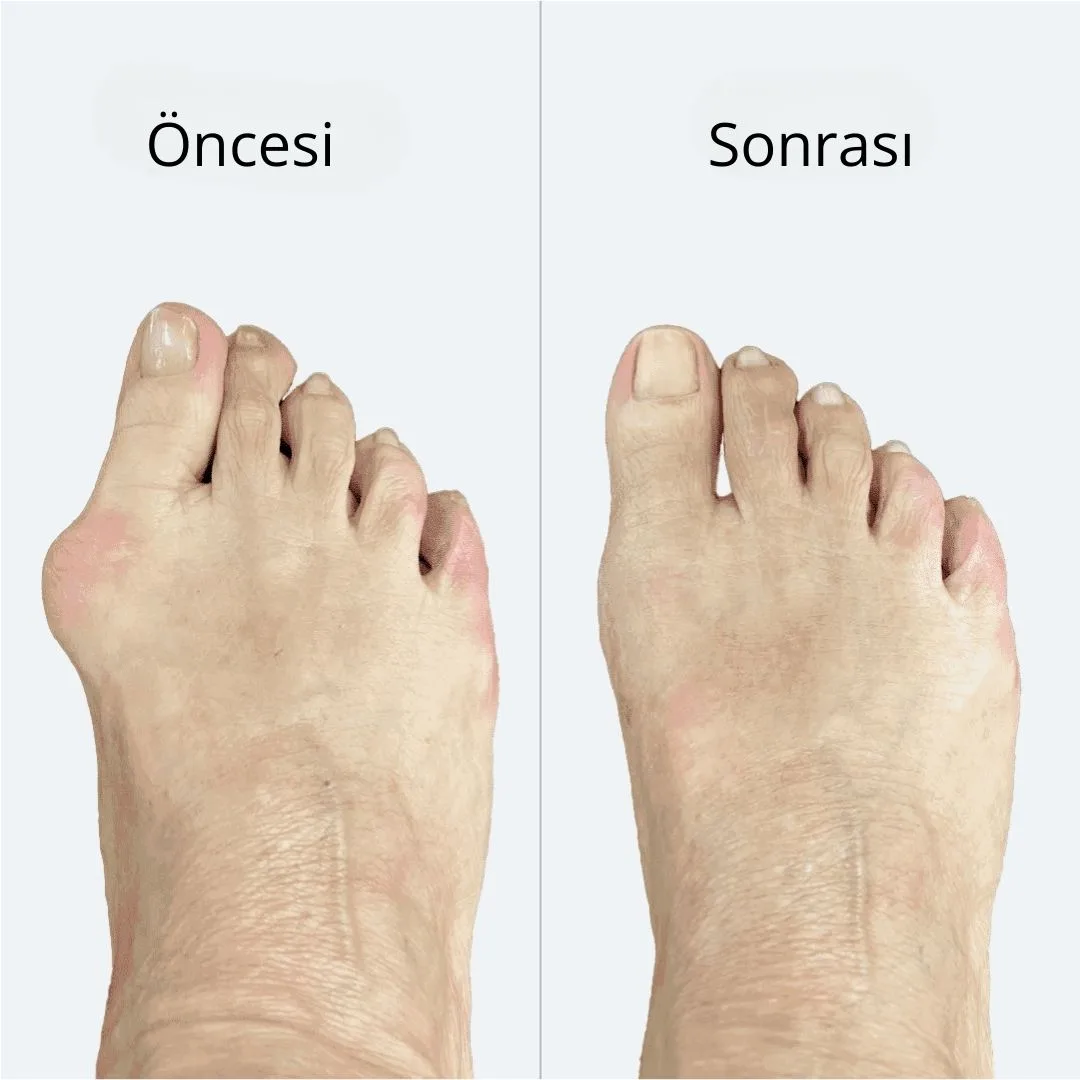 Selimmugrabi OnceSonra 2