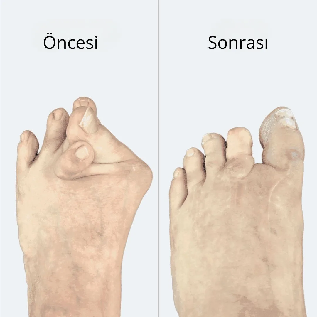 Selimmugrabi OnceSonra 3