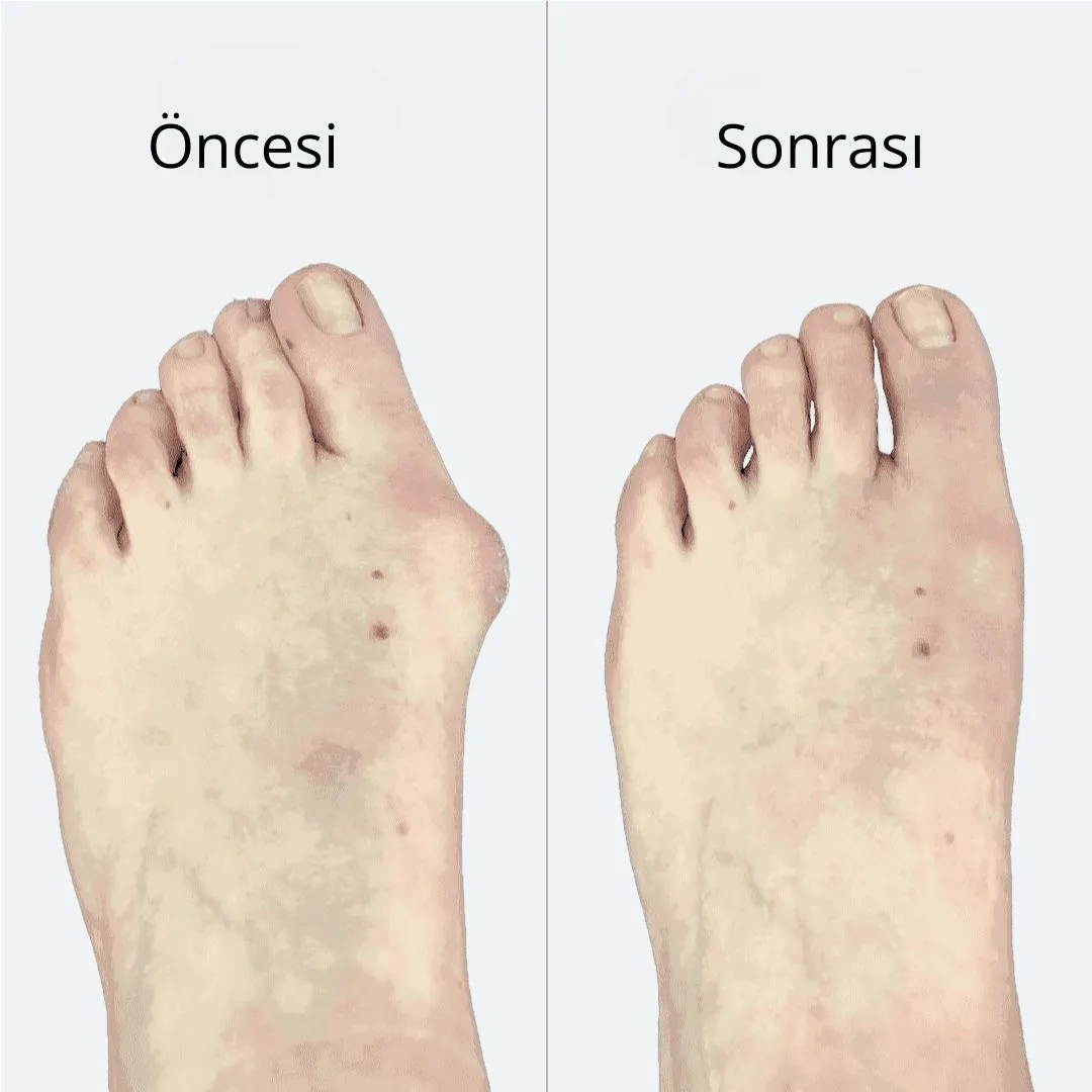 Selimmugrabi OnceSonra 5