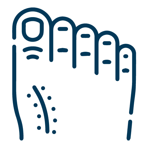 Halluks Valgus'da Minimal İnvaziv Yöntemi - LP 6 lessscars icon